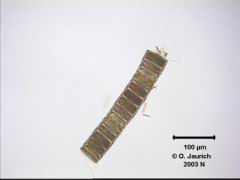 Bänder-Kieselalge 340x HF