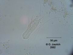 Bauchhärling 600x HF