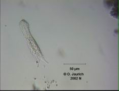 Bauchhärling 670x SB