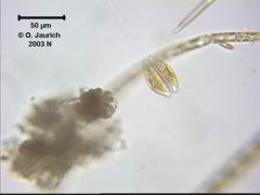 Bauchige Kahn-Kieselalge Cymbella ventricosa 670x HF