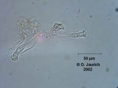 Beringtes Pokaltierchen 600x HF