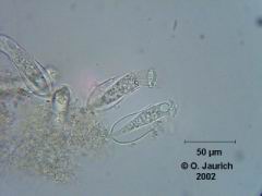 Beringtes Pokaltierchen 600x HF