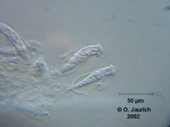 Beringtes Pokaltierchen 600x SB