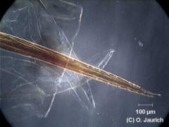 Bienenstachel 150x DF (Dauerpräparat)