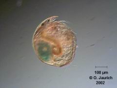 Blattfusskrebs (Zwergkrebschen Alonella) 150x HF, RB, SB