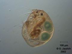 Blattfusskrebs (Zwergkrebschen Alonella) 150x HF, RB, SB, ohne Hintergrundkorrektur