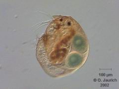 Blattfusskrebs (Zwergkrebschen Alonella) 150x HF, RB, SB, mit Hintergrundkorrektur