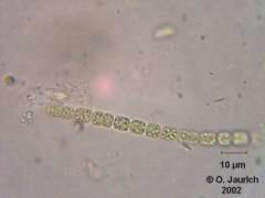 Blaualge Anabaena planctonica 1500x HF
