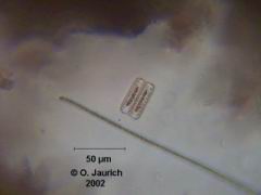 Blaualgen, Zickzack-Kieselalgen 600x HF