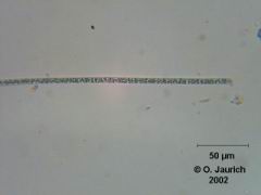 Blaualgenkolonie 600x HF