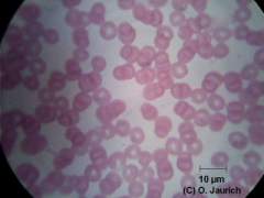 Blutausstrich vom Menschen 1500x HF (Dauerpräparat)