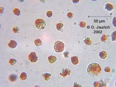 Blutregenalge 600x HF