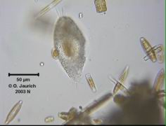 Ciliat mit Kieselalgen in der Nahrungsvakuole 680x HF