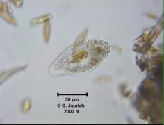 Ciliat mit Kieselalgen in der Nahrungsvakuole 680x HF
