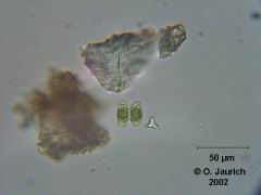 Grünalge: Doppelaugen-Alge 600x HF