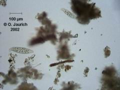 Doppelsichelciliat 150x HF