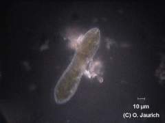 Eingeschnürte Sohlen-Kieselalge, Draufsicht 600x_DF