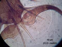 Fliegenfuß 600x HF (Dauerpräparat)