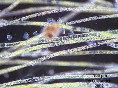 Glockentierchen auf Grünalgen 150x DF