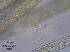 Glockentierchen auf Grünalgen 600x HF