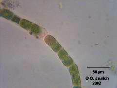 Grünlage Ulothrix zonata 1500x HF