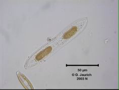 Grüne Rippen-Kieselalge 1100x HF