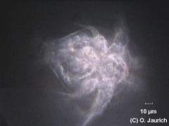 Larvenstadium vom Hüpferling 600x DF