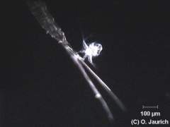 Larvenstadium vom Hüpferling (vor Schwanzborsten eines Alttieres) 150x DF