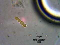 Fundort Moos am Gartenteich, April 2002, Alge 1500x HF. Welche Alge ist das?