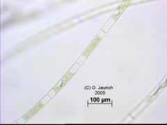 Jochalge Mougeotia 340x HF