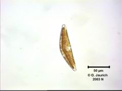 Kahn-Kieselalge Cymbella helvetica 670x HF