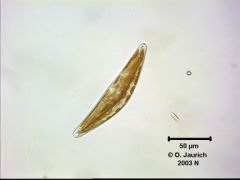 Kahn-Kieselalge Cymbella helvetica 670x HF