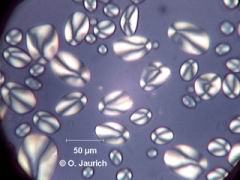 Kartoffelstärke, gekreuzte Polfilter, 600x HF
