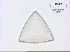 Kieselalge 1100x HF Ebene 1