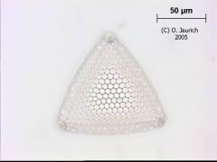 Kieselalge 1100x HF Ebene 5