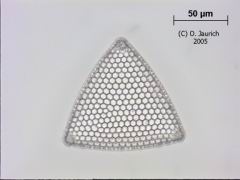 Kieselalge 1100x HF kombiniert
