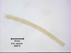 Kieselalge Fragiliaria 670x HF