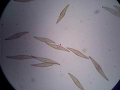 Kieselalge Pleurosigma angulatum 150x HF