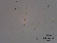 Stab-Kieselalgen 600x HF