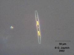 Stab-Kieselalge 600x DF