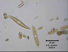 Kieselalgen Februar 2003 680x HF
