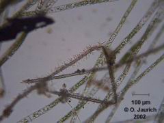 Kieselalgenbewuchs auf toter Grünalge 150x SB