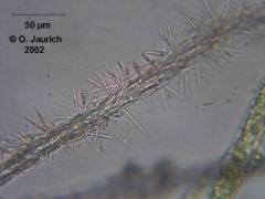 Kieselalgenbewuchs auf toter Grünalge 600x SB