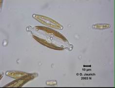 Kreuz-Kieselalge 1100x HF