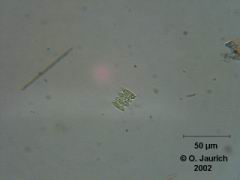 Grünalge: Langstachelige Gürtelalge 600x HF