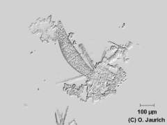 Mondalge 150x DF, Autoausgleichung von Kontrast und Helligkeit, Schärfe optimiert, Relief- (Emboss-) Funktion angewandt
