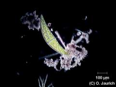 Mondalge 150x DF, Autoausgleichung von Kontrast und Helligkeit