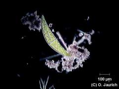 Mondalge 150x DF, Autoausgleichung von Kontrast und Helligkeit, Schärfe optimiert