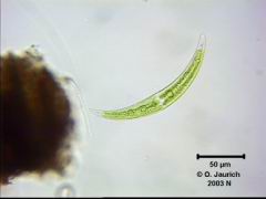 Mondsichelalge Closterium moniliferum 670x HF
