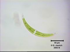 Mondsichelalge Closterium moniliferum 670x HF
